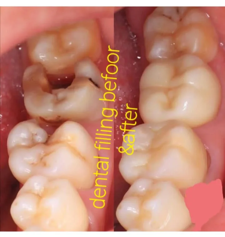 Alanya HEALTHY TEETH Dental Aesthetic — Медицина в Аланье: Онлайн-заказ, цены и отзывы